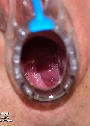 old nurse, exposed nurses