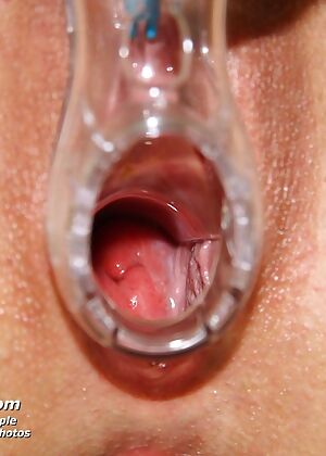 nurse, exposed nurses