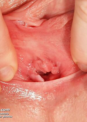 nurse, exposed nurses