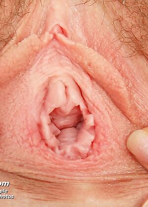 nurse, exposed nurses